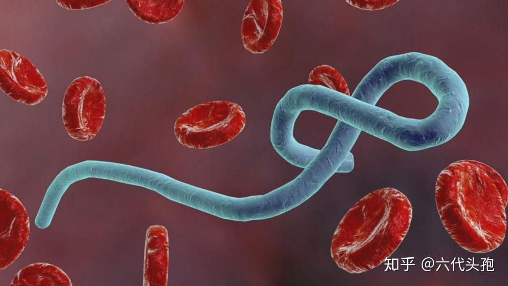 西班牙流感(spanish flu)