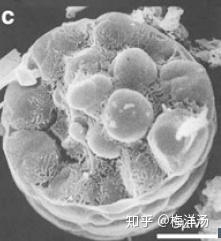 “重度结石细菌”——小石子细菌Achromatium(2)