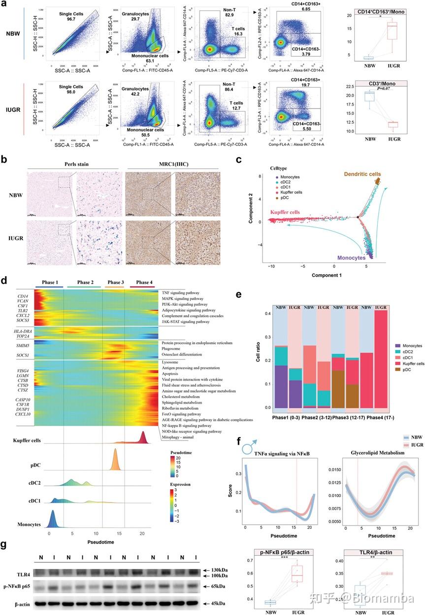 IF14.3| scRNA-seq+脂质组多组学分析揭示宫内生长受限导致肝损伤的性别差异 - 知乎