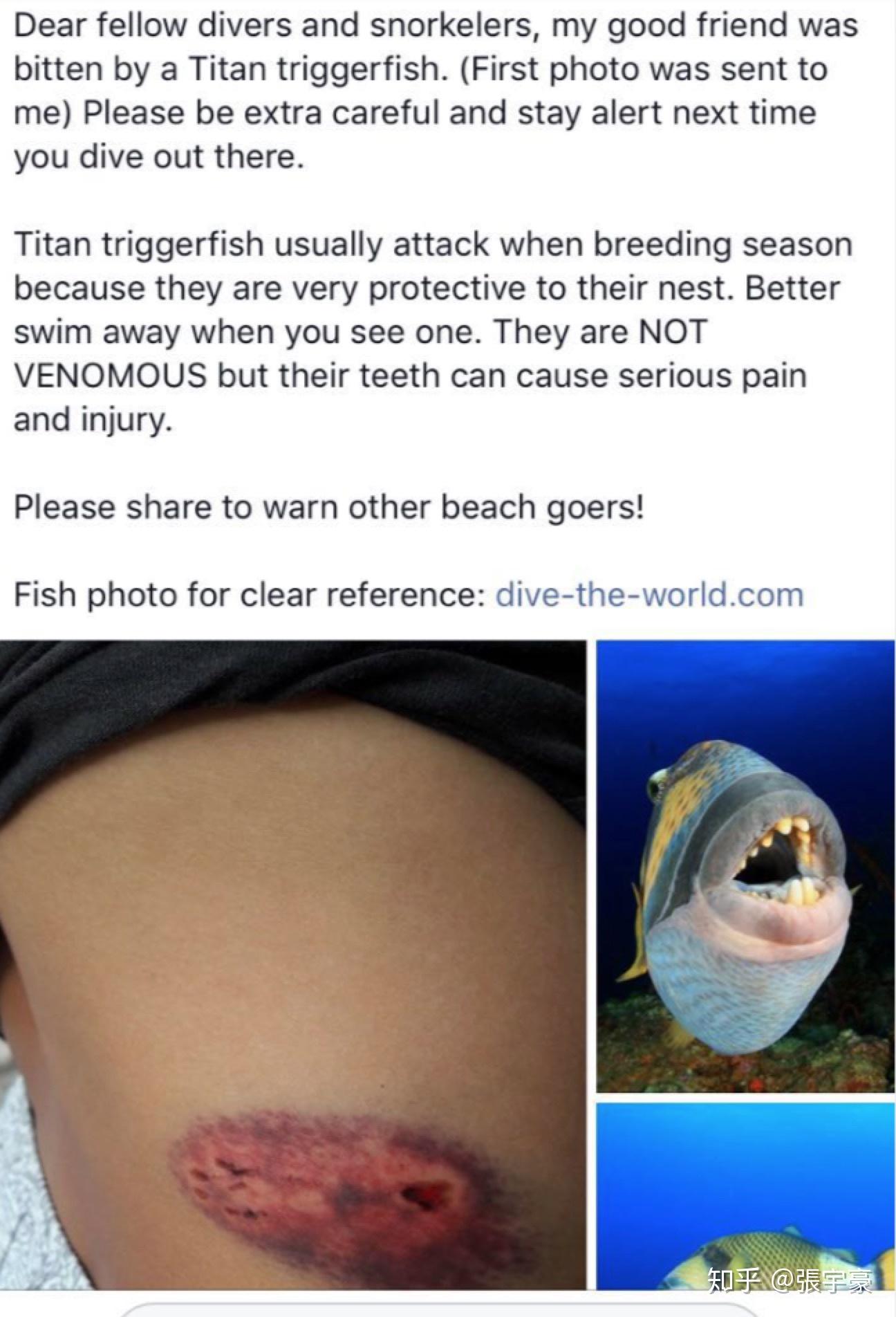 拔罐为什么不能每天连着拔罐 v2-0f5d73a44262883b3ecd89c4cea44737_r.jpg