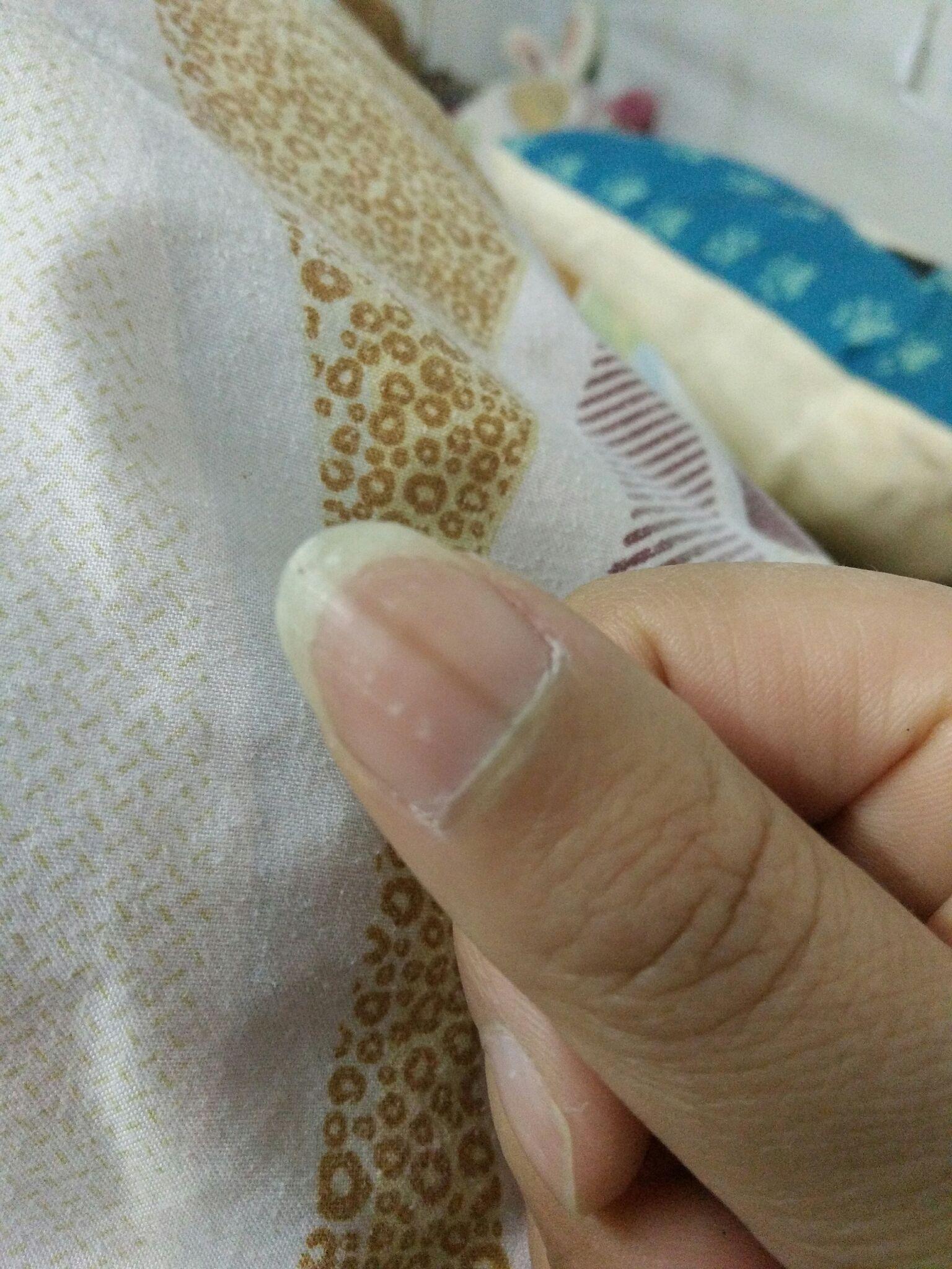 大拇指上长了根很粗的黑线有一年了是缺锌吗22岁