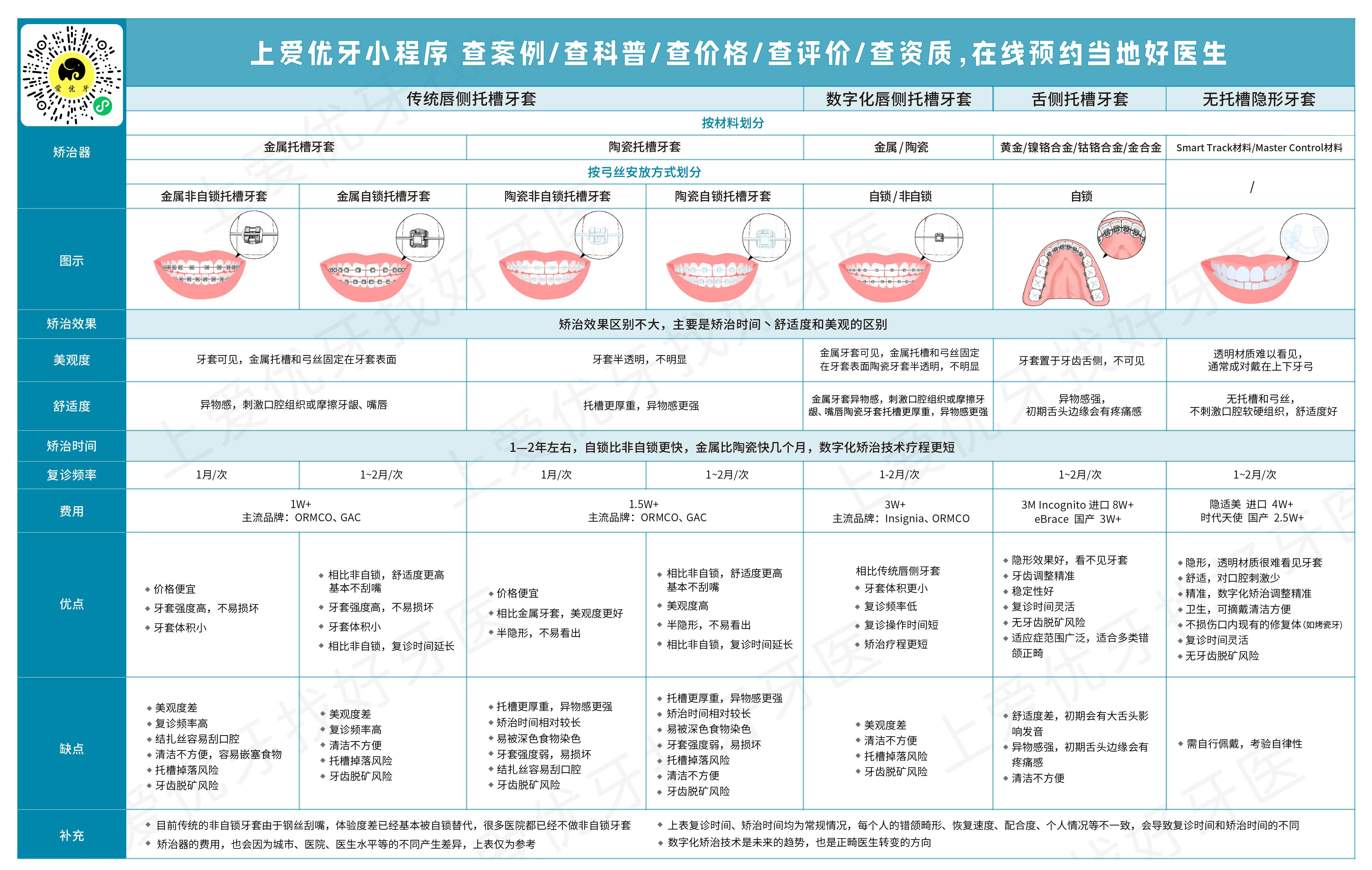 北京牙齿矫正北京整牙攻略包括牙齿矫正的原理牙套类型及其价格完整的