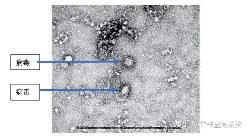 电镜技术 让新冠病毒一览无余 知乎 