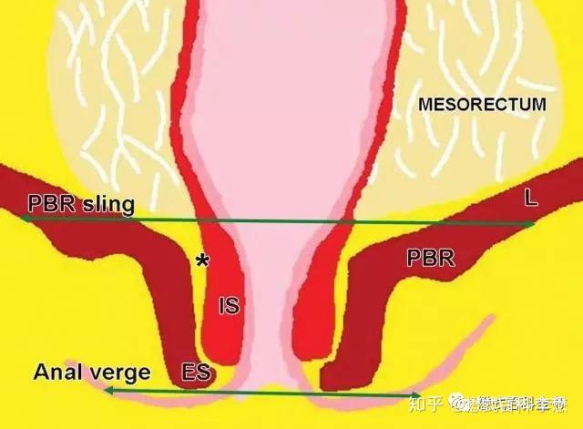 磁共振直肠扫描二