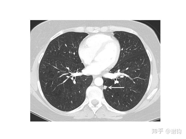 现代医学成像3ct基本原理与图像重建