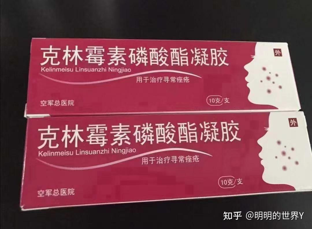 如果是胸口后背大面积出现痘痘的,推荐口服北京中医院的痤疮清热合剂.