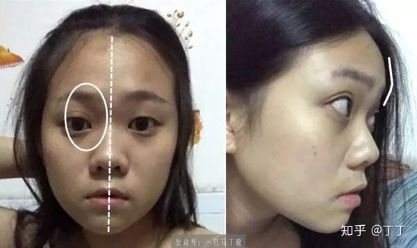 读者分析扁平脸大鼻子的小女生怎样走少女路线