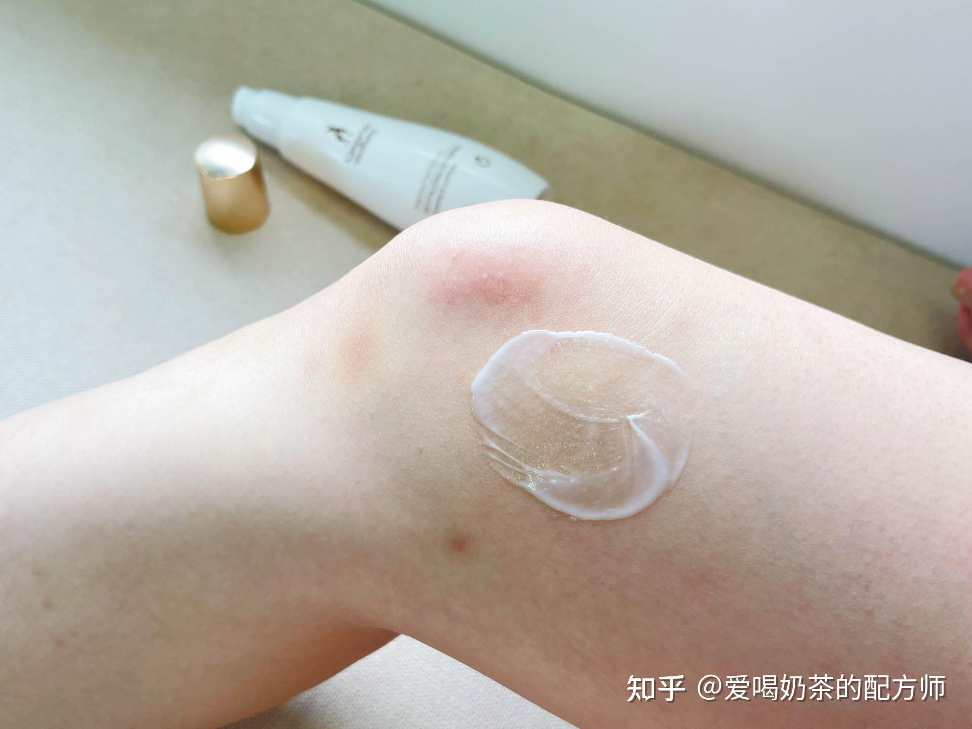 ③涂抹精华油(每天涂抹)