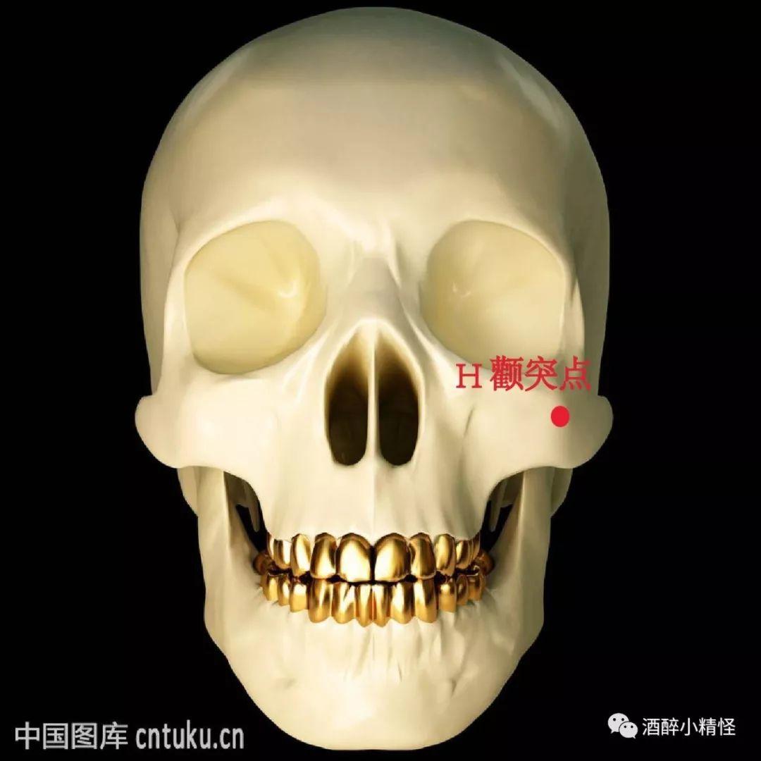 张笑天：颧骨内推手术对高颧骨有效果吗_凤凰网健康_凤凰网