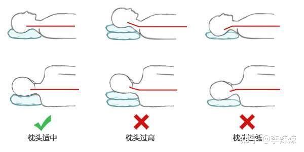 2021全品类颈椎枕头测评:颈椎曲度变直,反弓应该用什么枕头?
