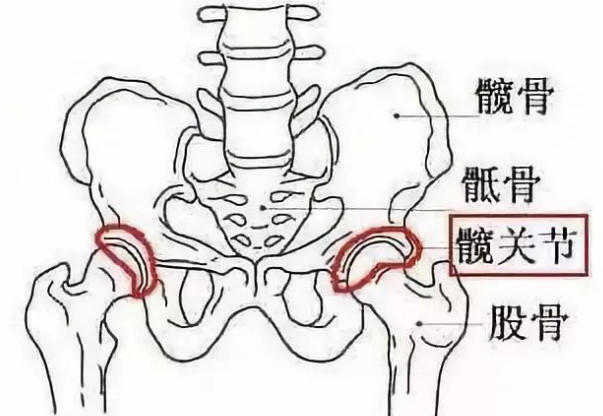 髋关节撞击症丨没听说过你可能已经深受其害
