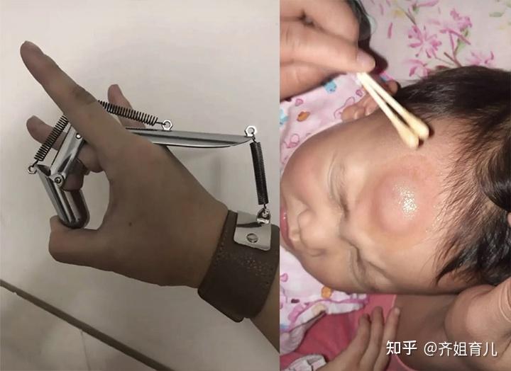 这个爸爸弹之前大概觉得没什么,不至于,却不知道孩子非常娇嫩,这些