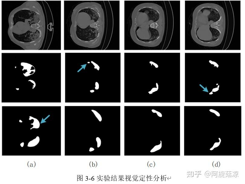 新冠肺炎ct圖像分割