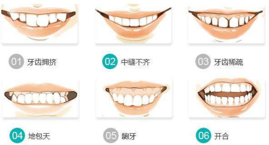v2-10db7e56f6e3471f50d29db559408133_1440w.jpg?source=172ae18b