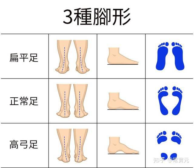 再有通过观察来判断,自己是不是正常足形,从后观察跟腱和小腿的方向