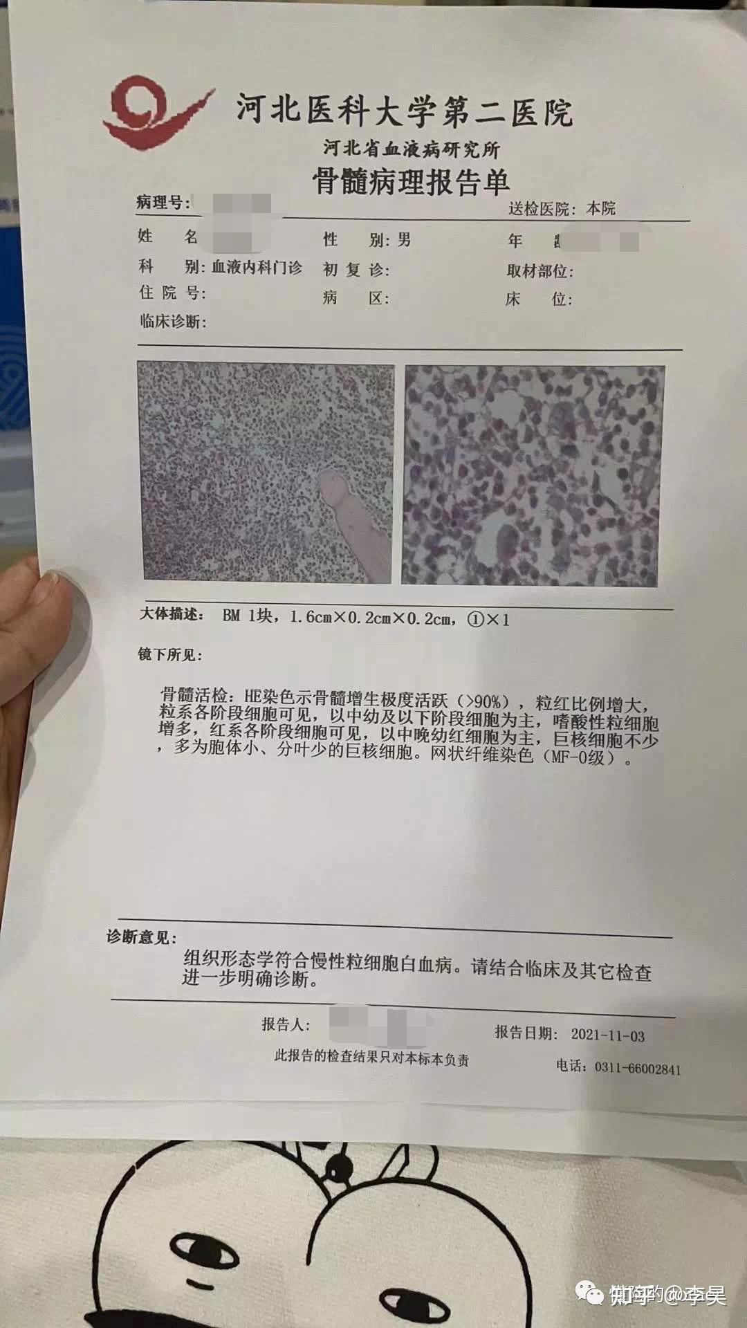 白血病化验单图片