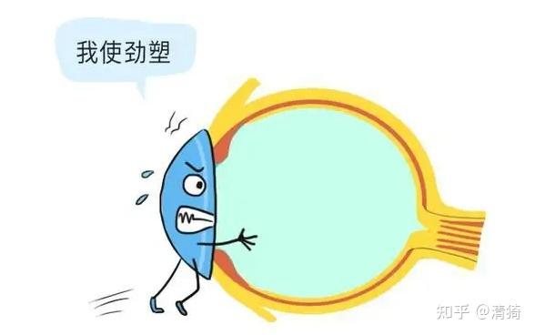 角膜塑形,英文全名叫orthokeratology,也被稱為