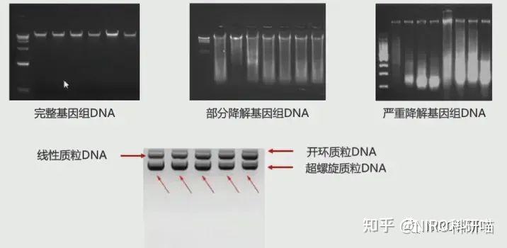 实验技能 | 第一期:常见核酸(DNA)提取和纯化的方法 - 知乎