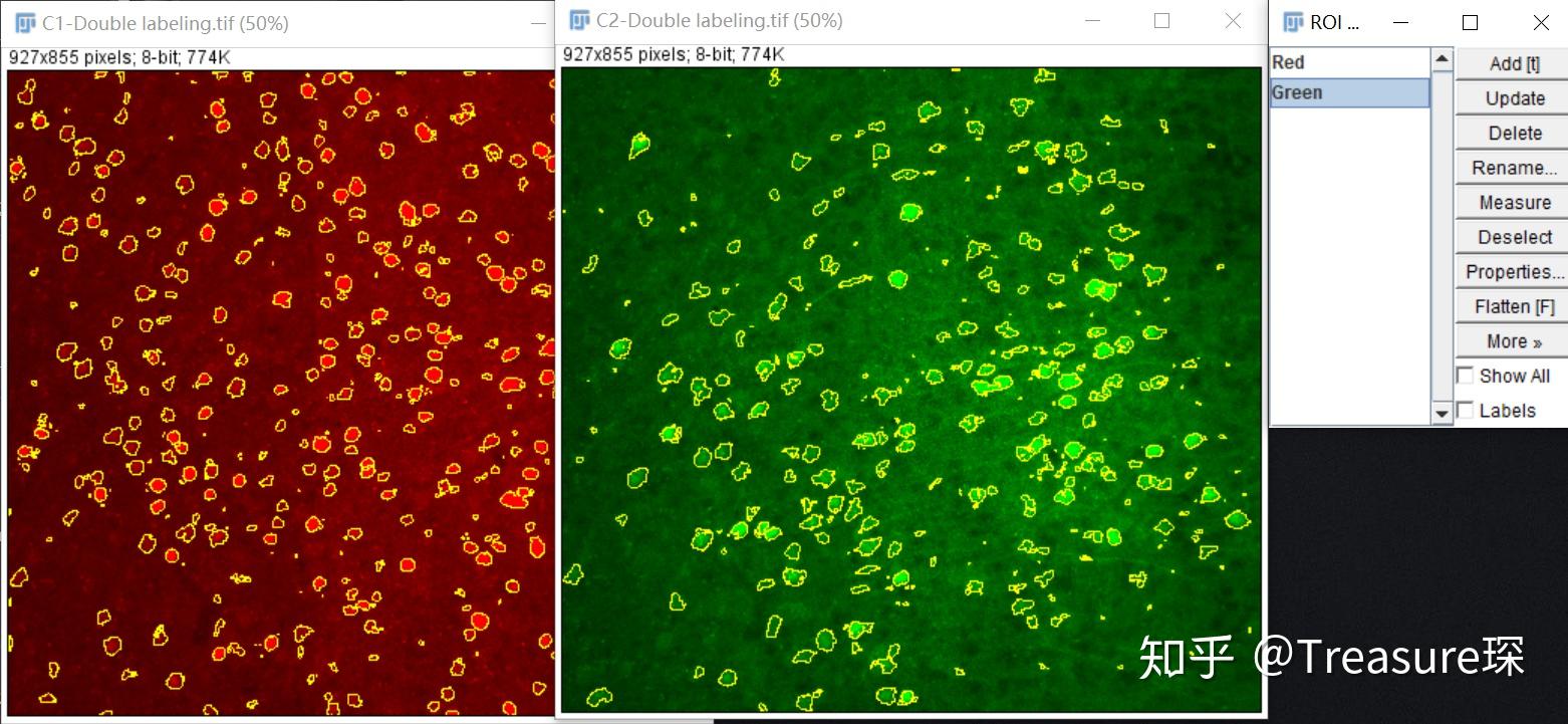 ImageJ实用技巧——荧光共标细胞计数(解放双手篇) 知乎