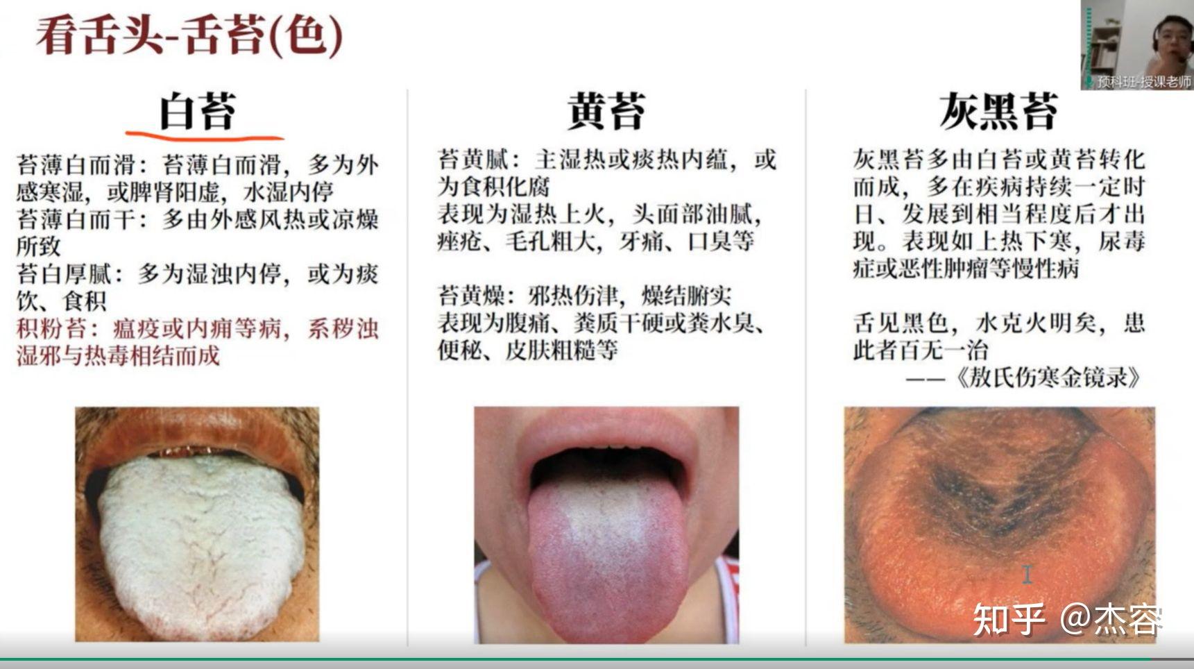 中医学习笔记5:舌诊 - 知乎