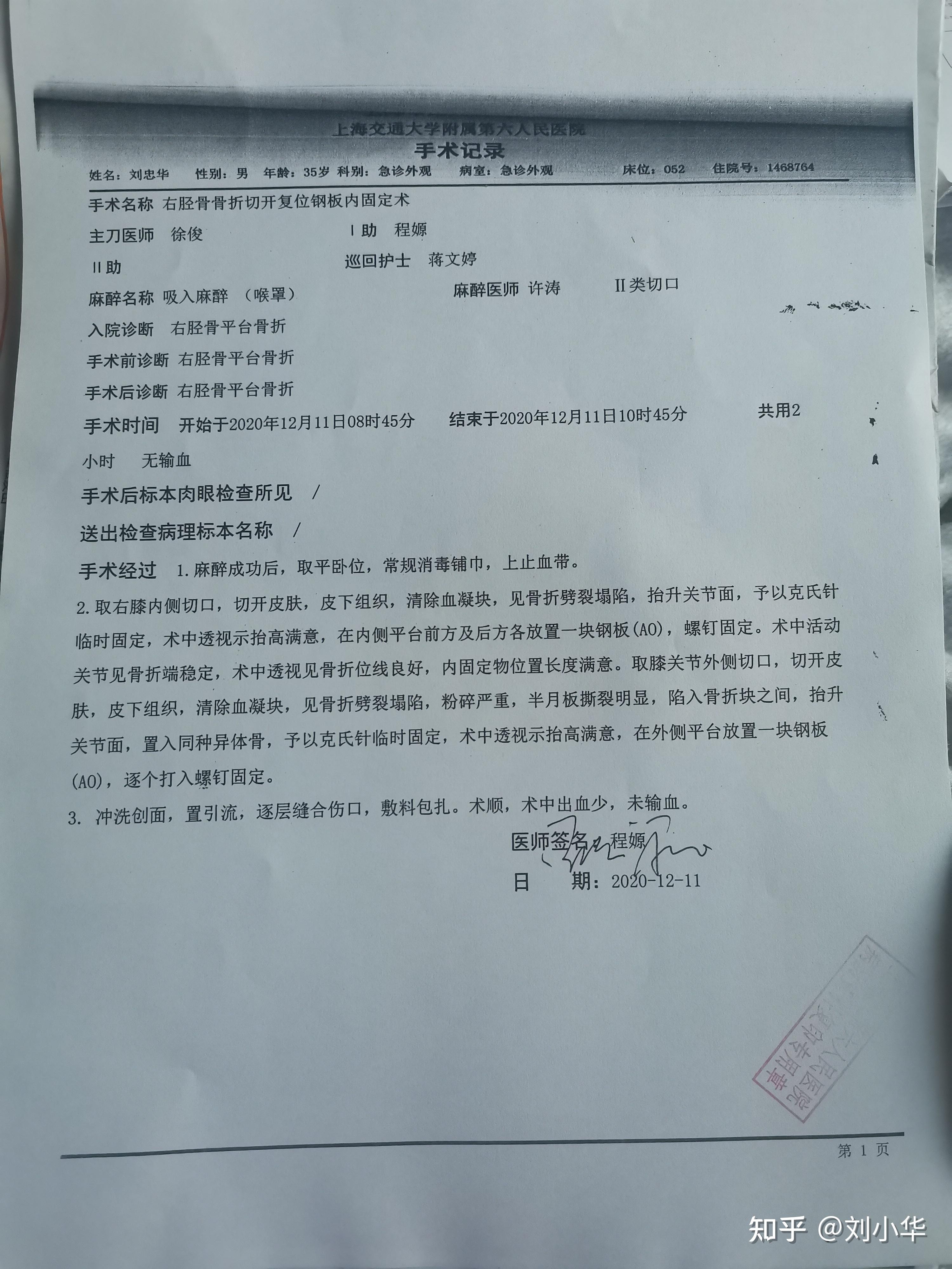 胫骨平台粉碎性骨折未来可期吗