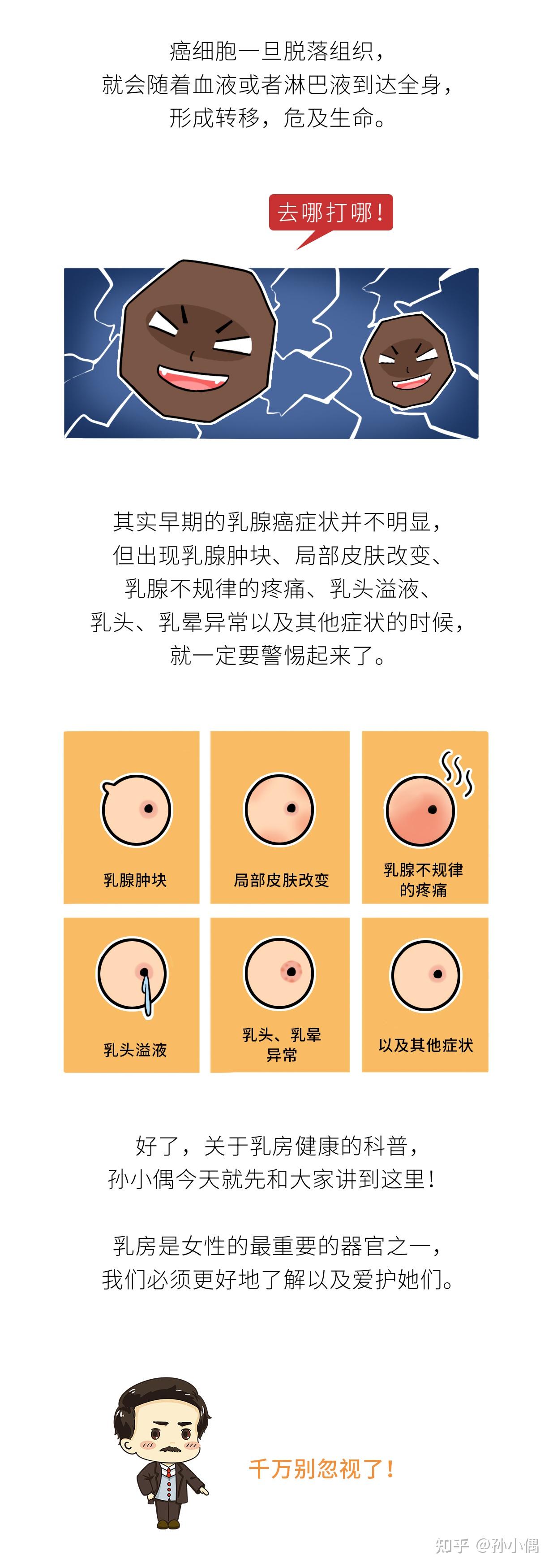 女性乳头 正常 色泽图片