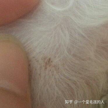 身上瘙痒是什么病 v2-11bf67265c10d14a242a8fcbc8e266c3_b.jpg