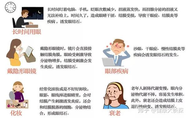 眼结石真的是眼睛里的石头吗