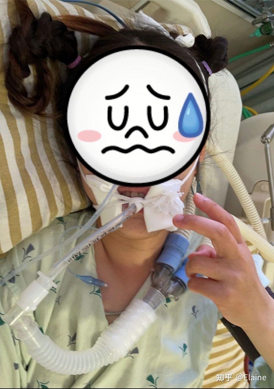 没办法自主呼吸,我呼吸逐渐衰竭,在8/31插管(插管顶到喉咙的不适感