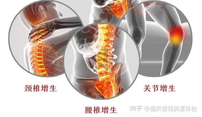 乳腺增生、前列腺增生……体检查出增生建议这样做！ - 知乎