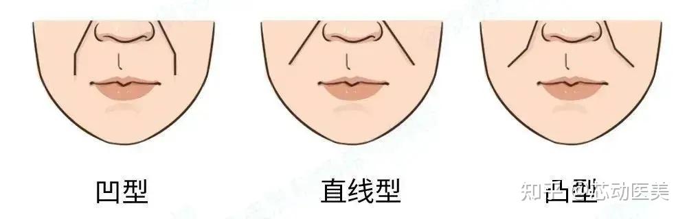为什么年纪轻轻就有法令纹呢?法令纹是怎么形成的? - 知乎