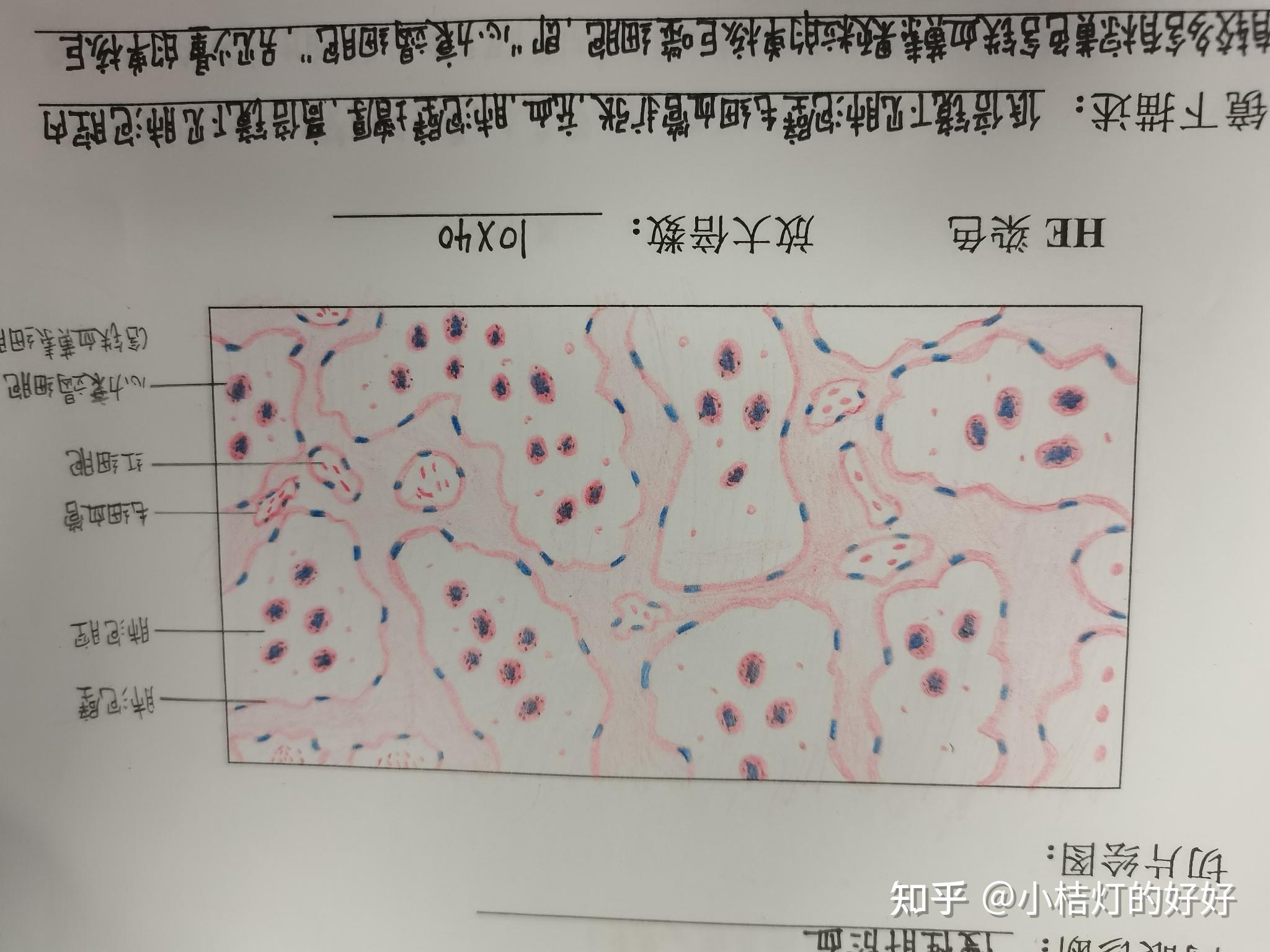慢性肺淤血红蓝手绘图片