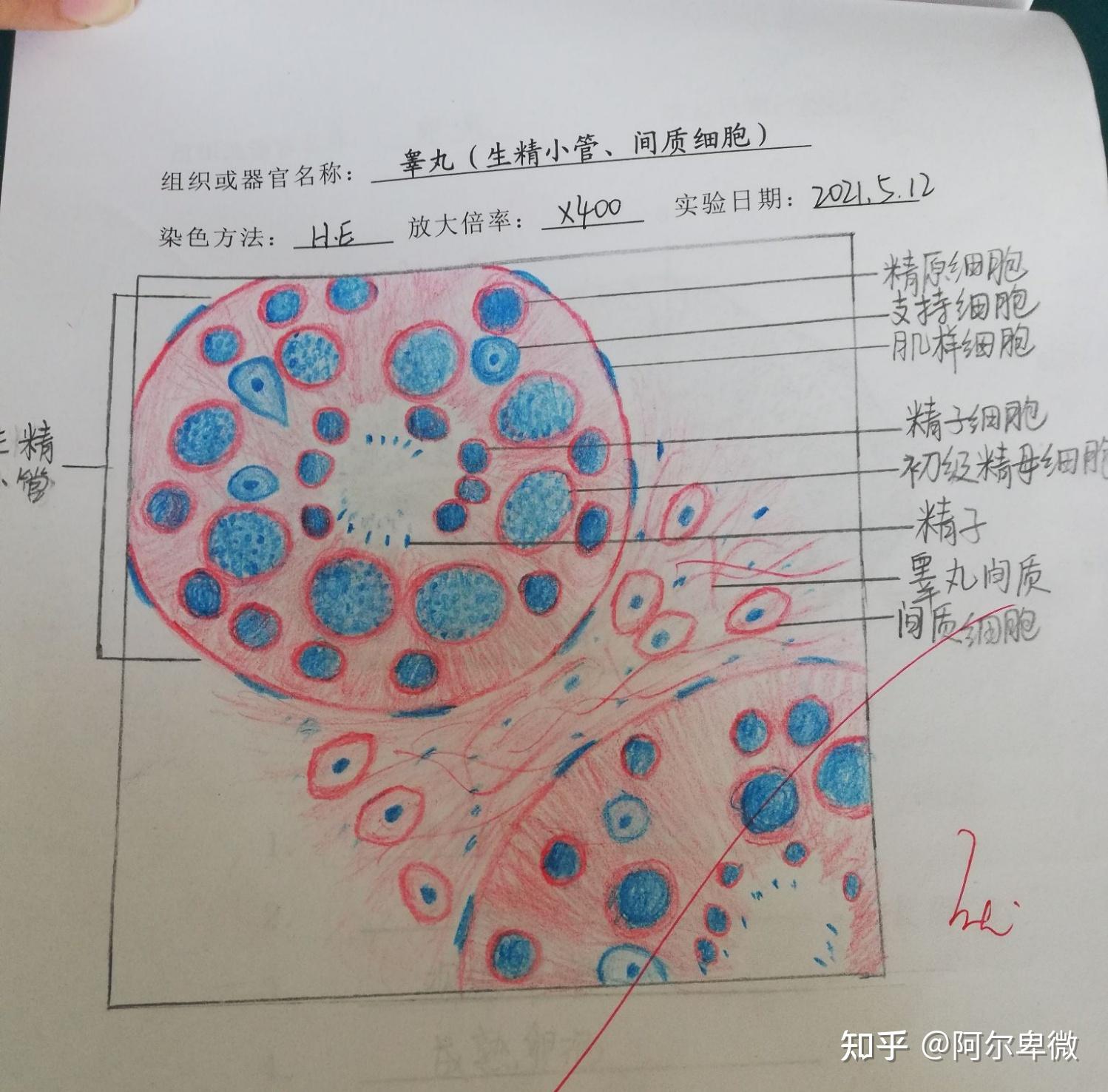 子宫红蓝铅笔手绘图图片