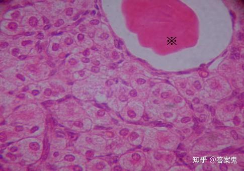 圖17-4卵巢(貓卵巢 he染色10×20) 圖示次級卵泡的卵泡膜(a),卵泡腔(b