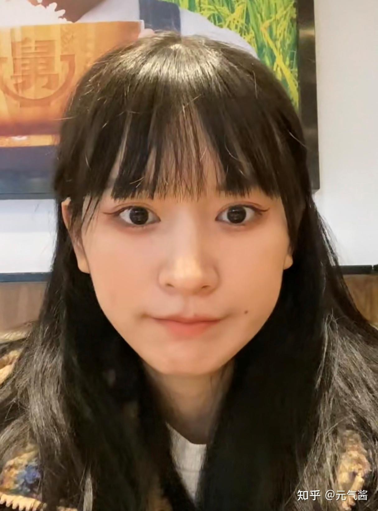 为了过心理那关容貌焦虑女孩还是去上海做了下颌角磨骨心得分享