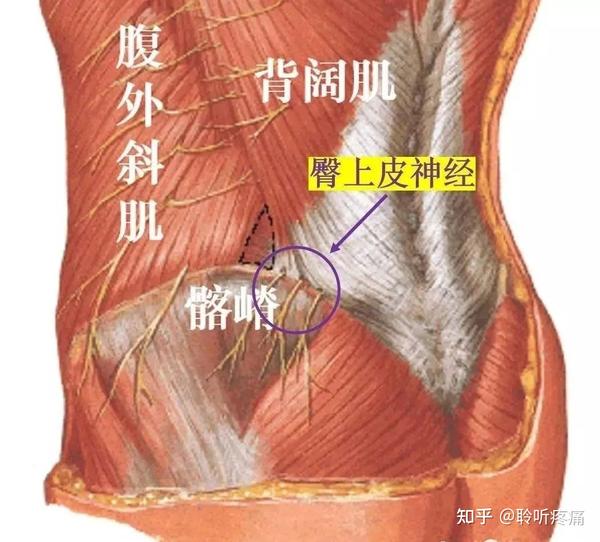 干货 从筋膜的角度看腰痛 腰肌筋膜炎是个什么东西 知乎