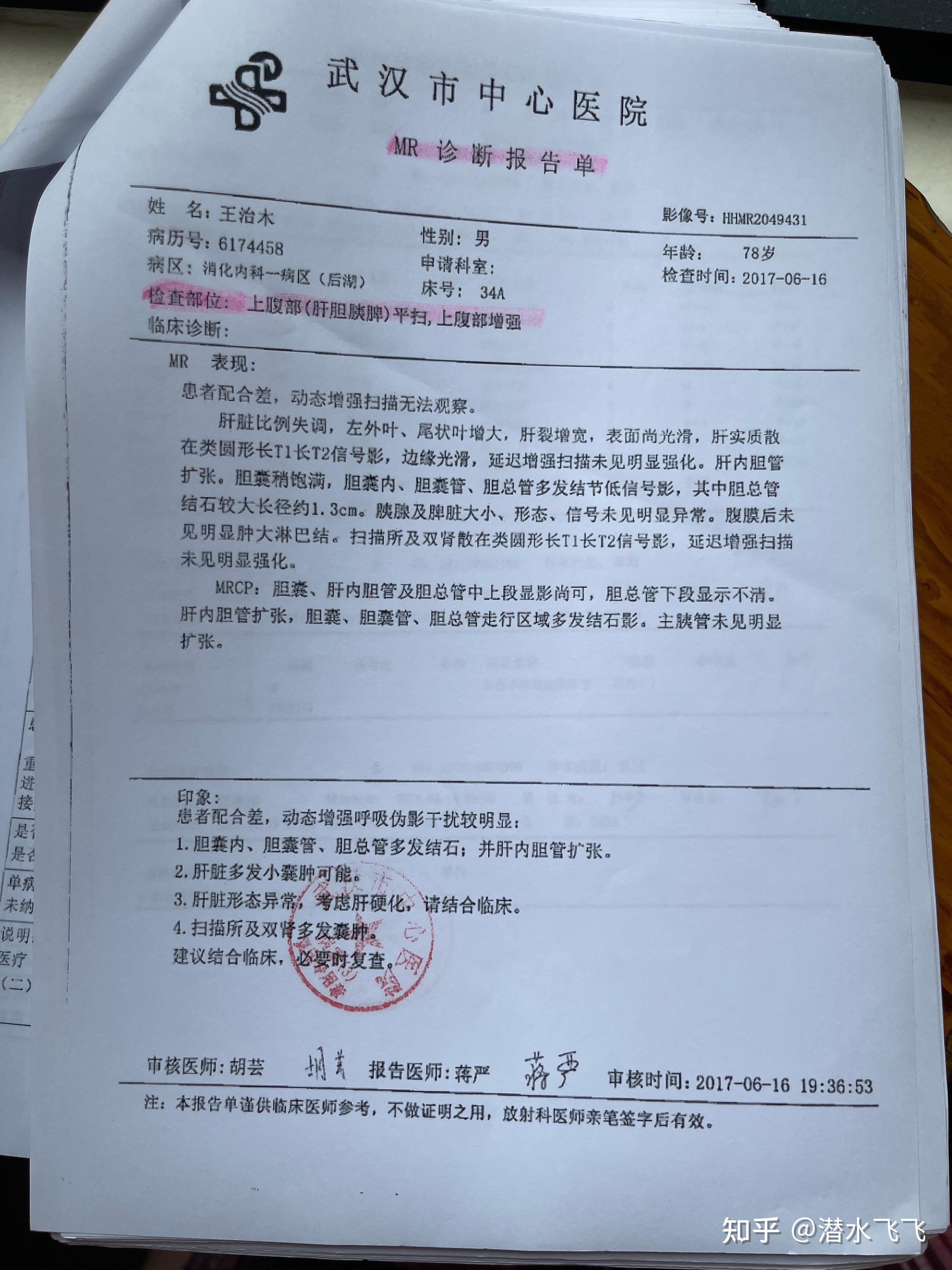 黄疸309.8入院诊断胆结石56天后以肝硬化失代偿期离世