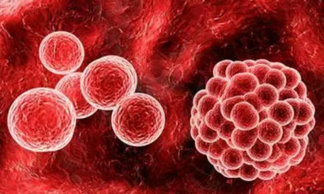 罕见病 | 治疗急性骨髓性白血病或许指日可待