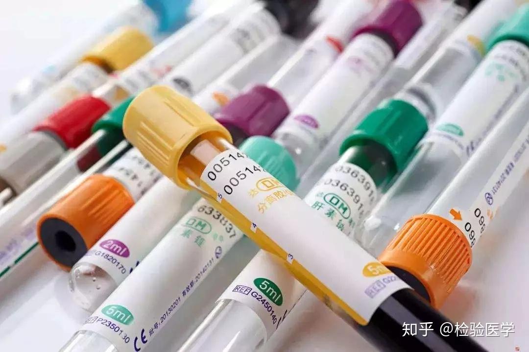 血液样本真空采集管知识盘点！_https://www.jmylbn.com_新闻资讯_第1张