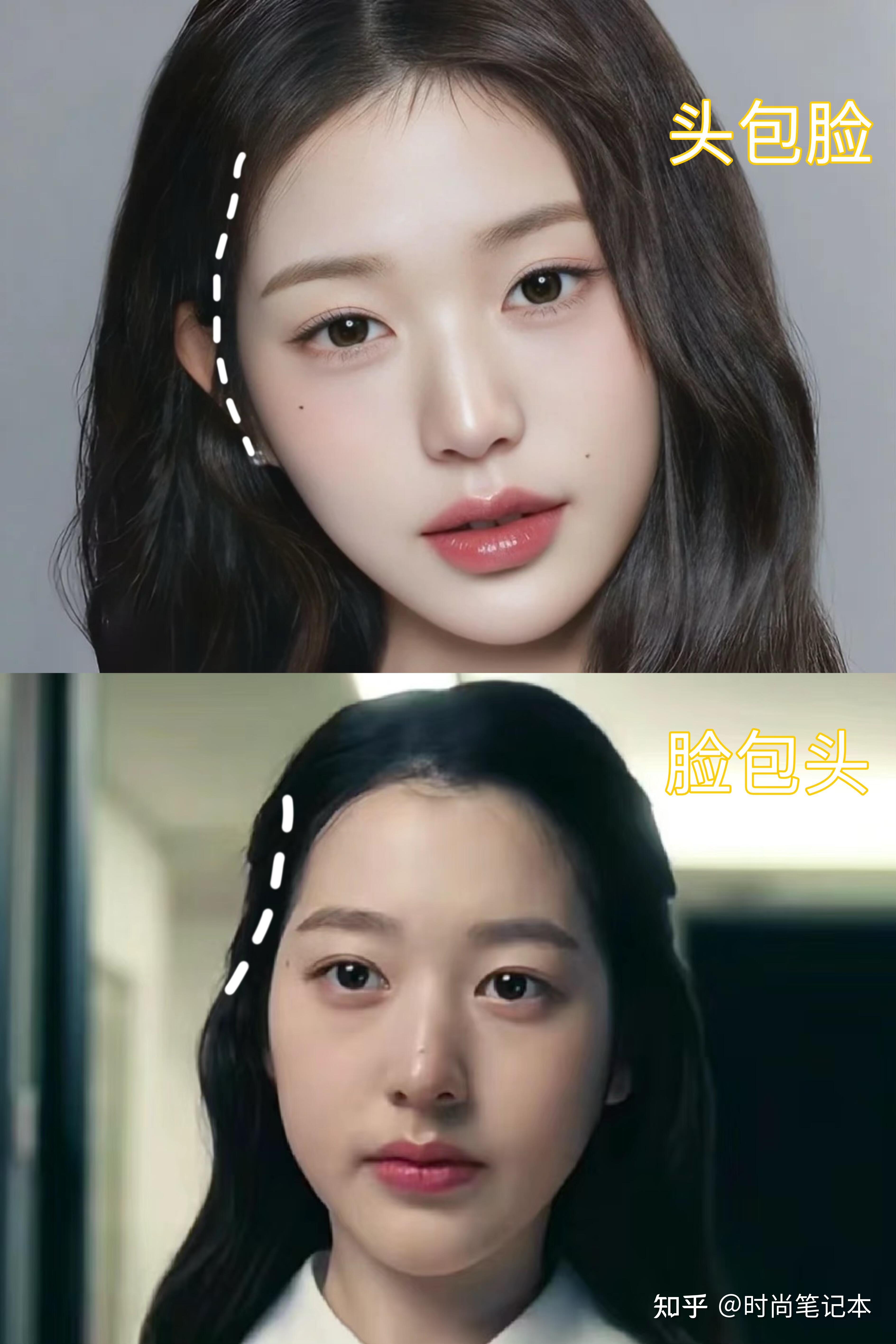 我发现美女都有一个共同的特点👀大美女的共性：颞部饱满 - 知乎