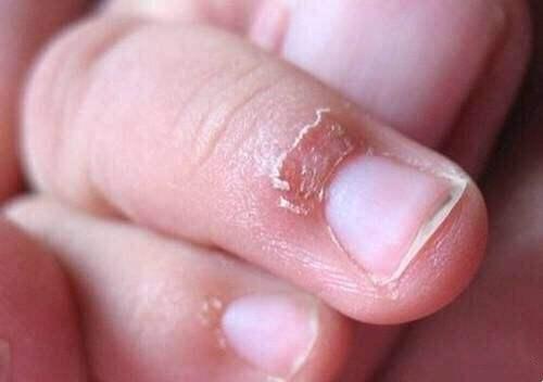 小孩咬指甲的后果图片图片