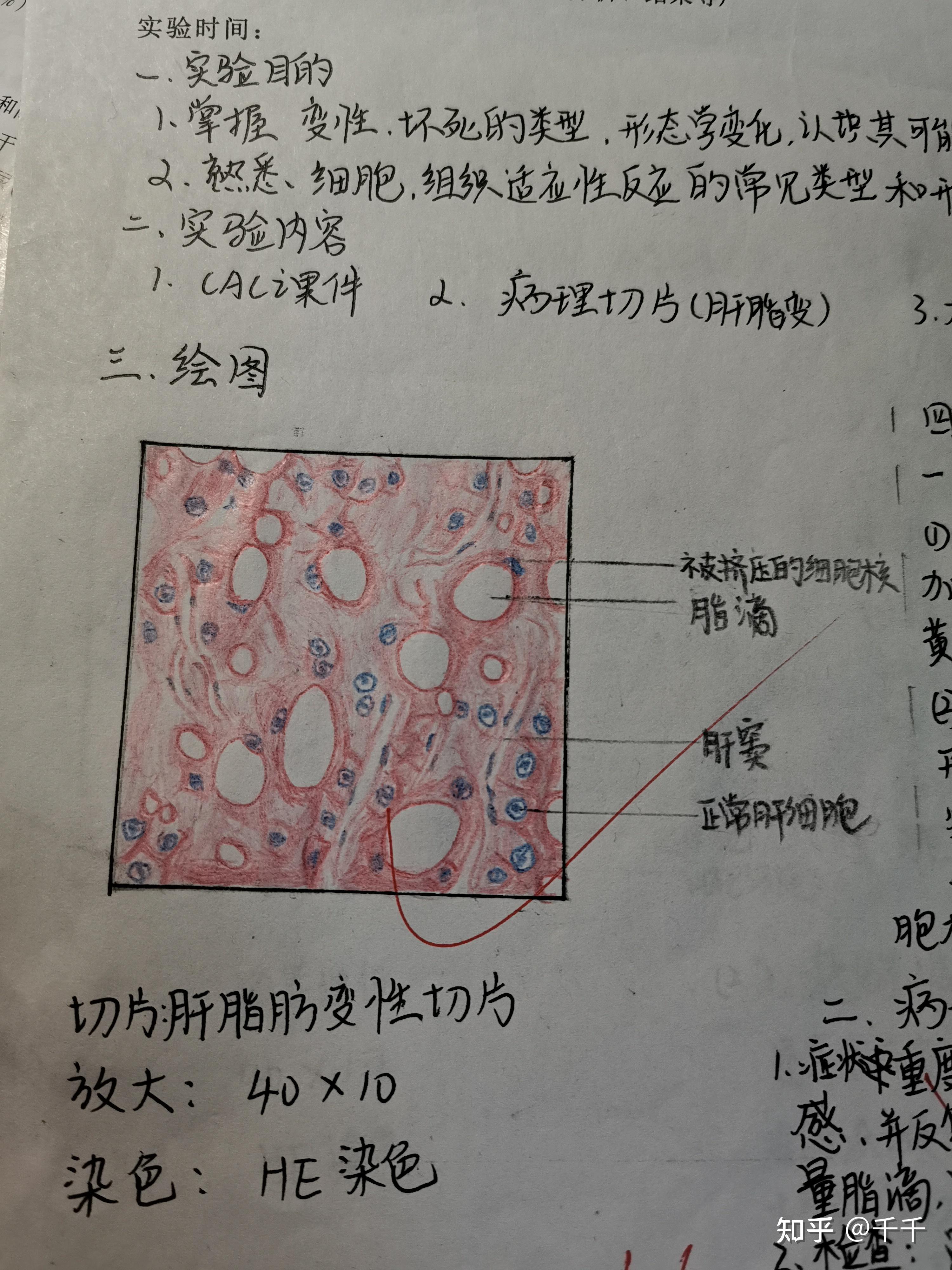 脂肪变性红蓝铅笔图图片