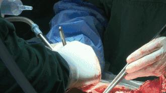 在健康的命根子上动刀,本来就是没事找事;多的这事儿,相应担的这风险