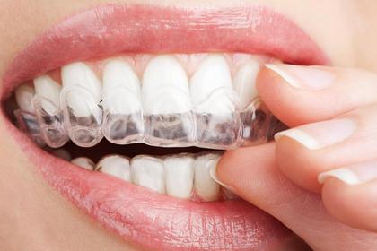 暑假矫正牙套怎么选