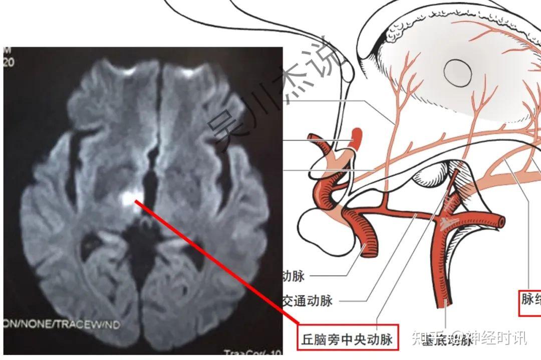 图文详解丘脑的血液供应