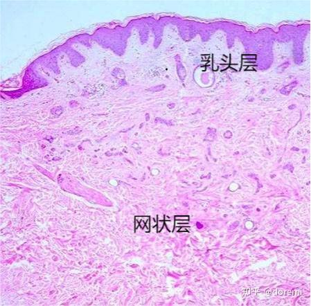 真皮网状层图片