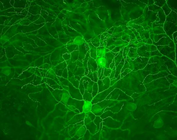 光敏通道蛋白和绿色荧光蛋白 图片来自http://statnewscom