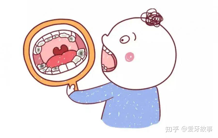 乳牙龋齿要治吗?