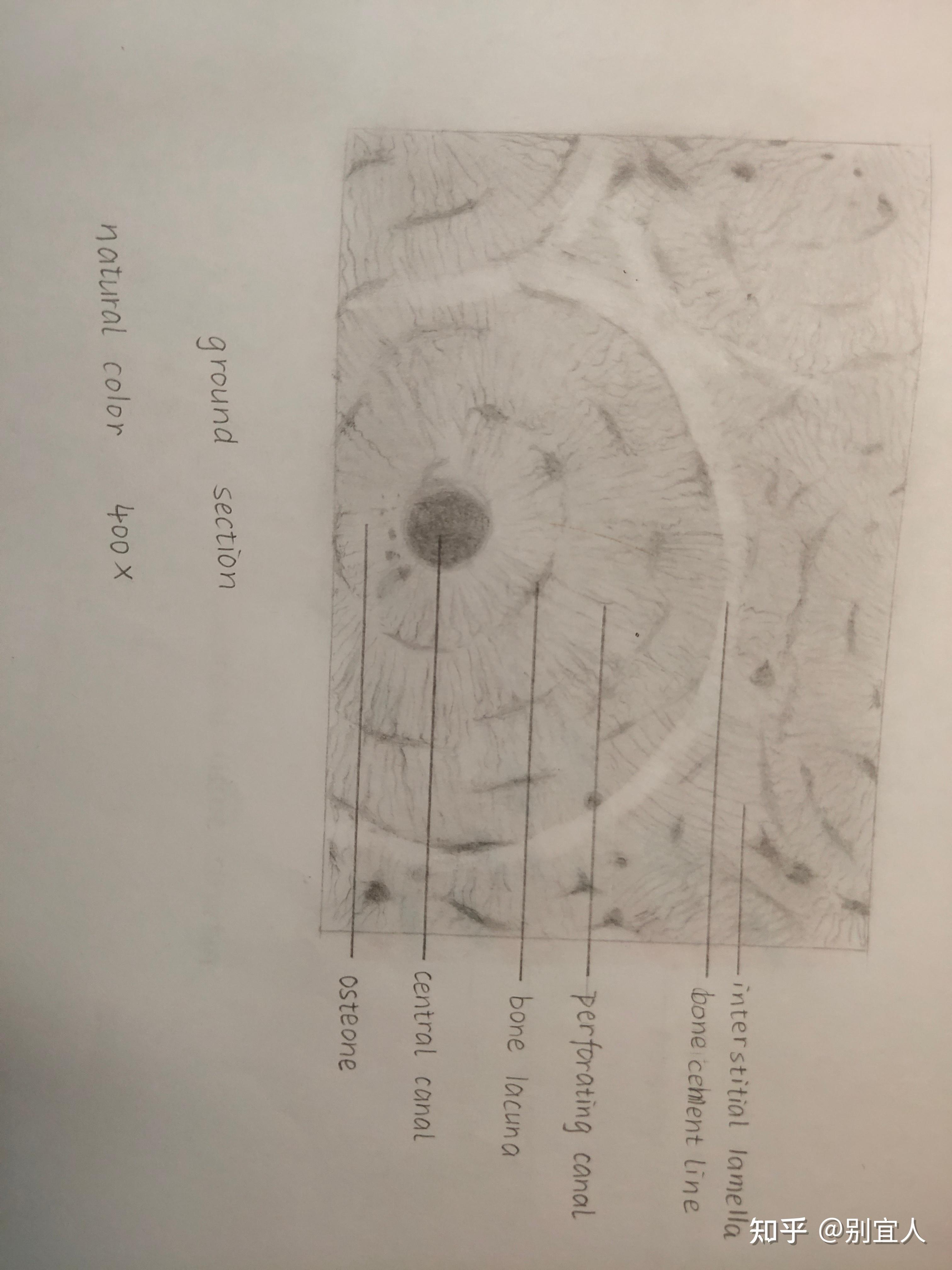 组胚密质骨绘图图片