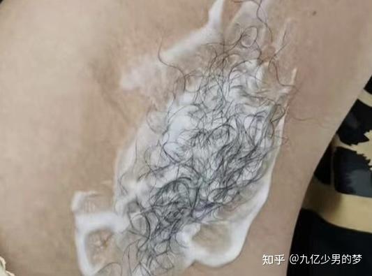 女生第一次脱毛,有什么脱毛膏推荐?脱毛膏会越脱越多吗?